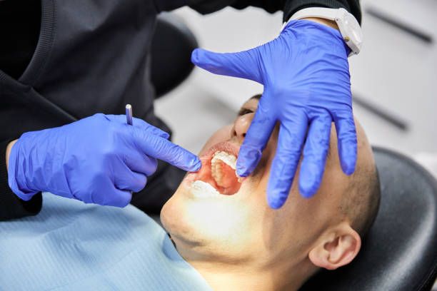 Best Emergency Root Canal Treatment in Hillburn, NY